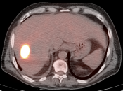 Case 7 (Image 6)
