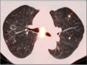 Case 5 (Image 6)