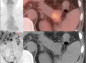 Case 1 (Image 6)