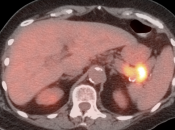 Case 4 (Image 6)