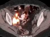 Case 5 (Image 6)