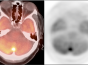 Case 7 (Image 6)
