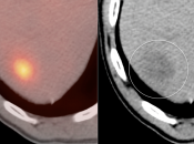 Case 5 (Image 6)