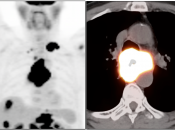 Case 1 (Image 6)