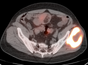 Case 7 (Image 7)