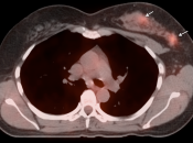 Case 1 (Image 9)