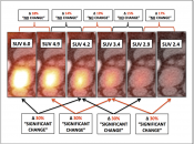 Figure 1 (Image 1) Change in SUV graphic